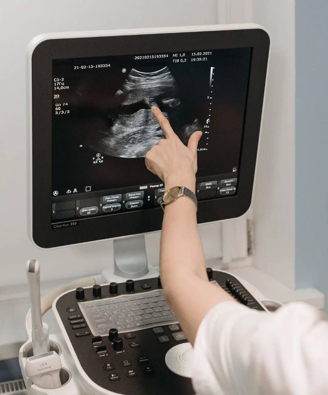 veterinary ultrasound machine